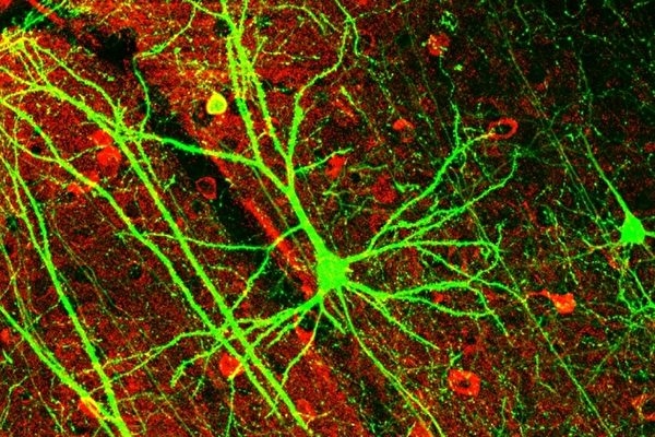 人体科学